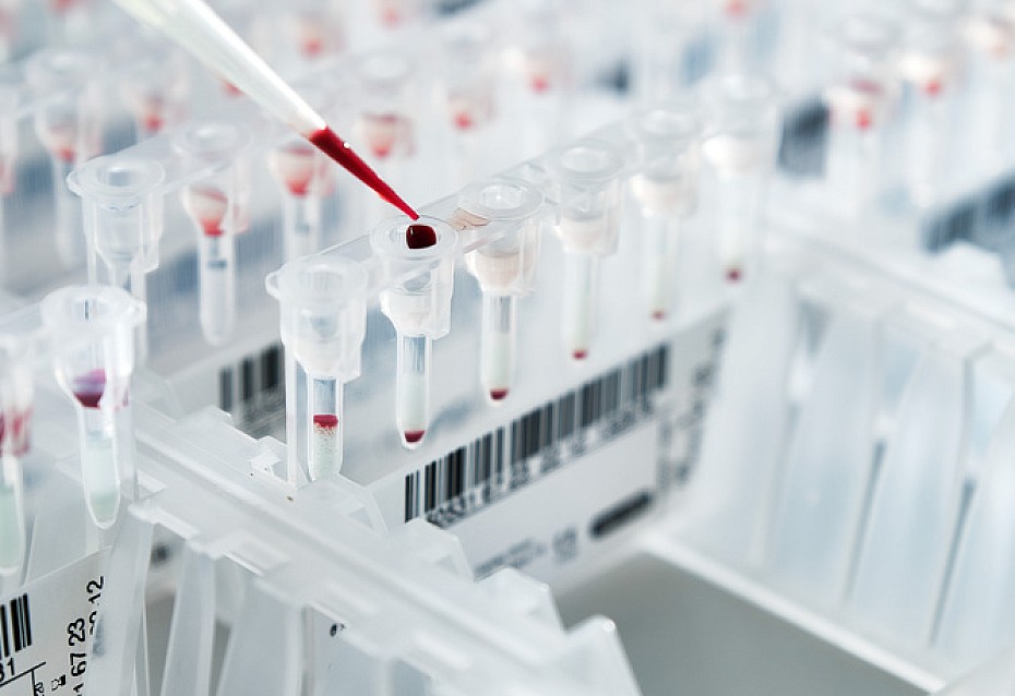 Detailaufnahme einer Pipette mit Blutprodukten im Labor